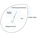 Breast Ultrasound Examination Phantom 
"BREAST FAN"