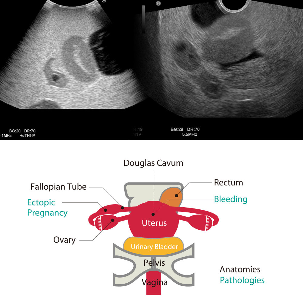 Female Pelvic Ultrasound Phantom - Gynae