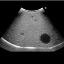 Fundamental Ultrasound Phantom