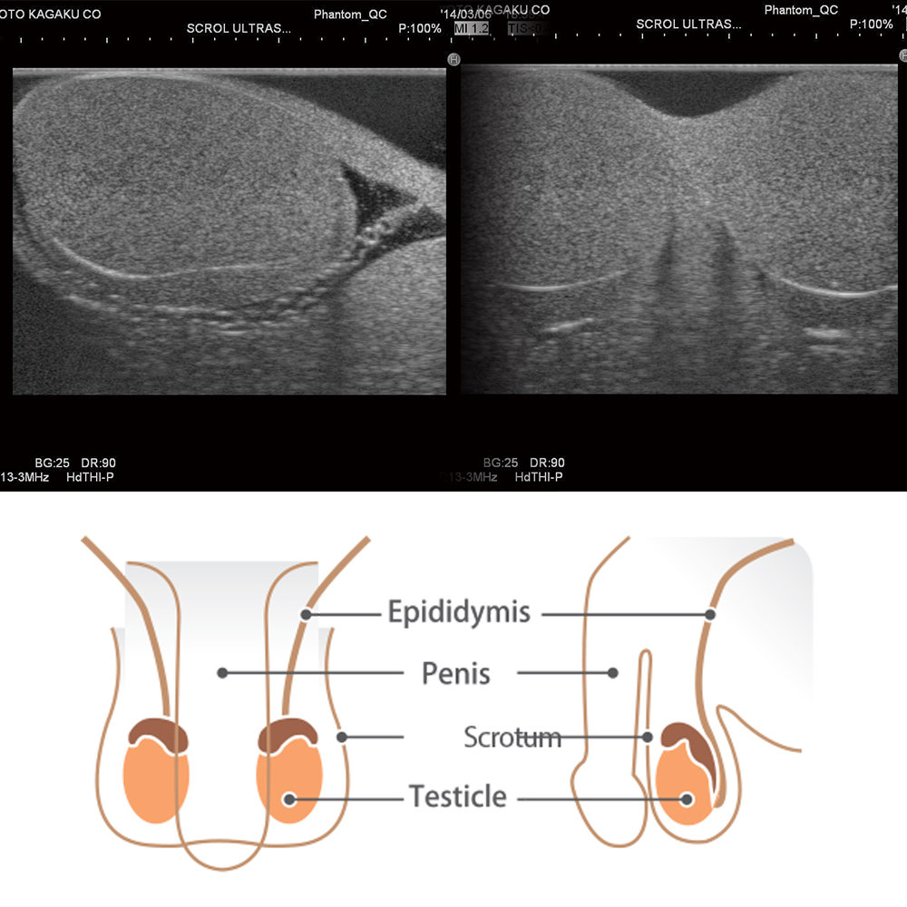 Scrotal Ultrasound Phantom