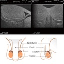 Scrotal Ultrasound Phantom