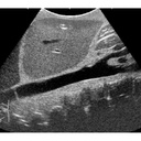 Ultrasound Examination Training Phantom "ECHOZY"