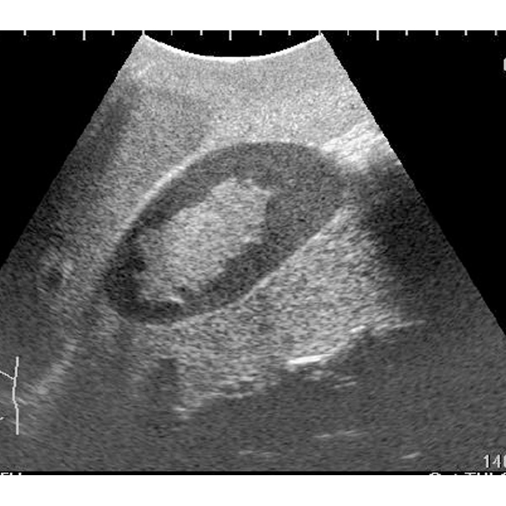 Ultrasound Examination Training Phantom "ECHOZY"