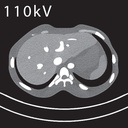 CT Abdomen Phantom