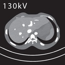 CT Abdomen Phantom