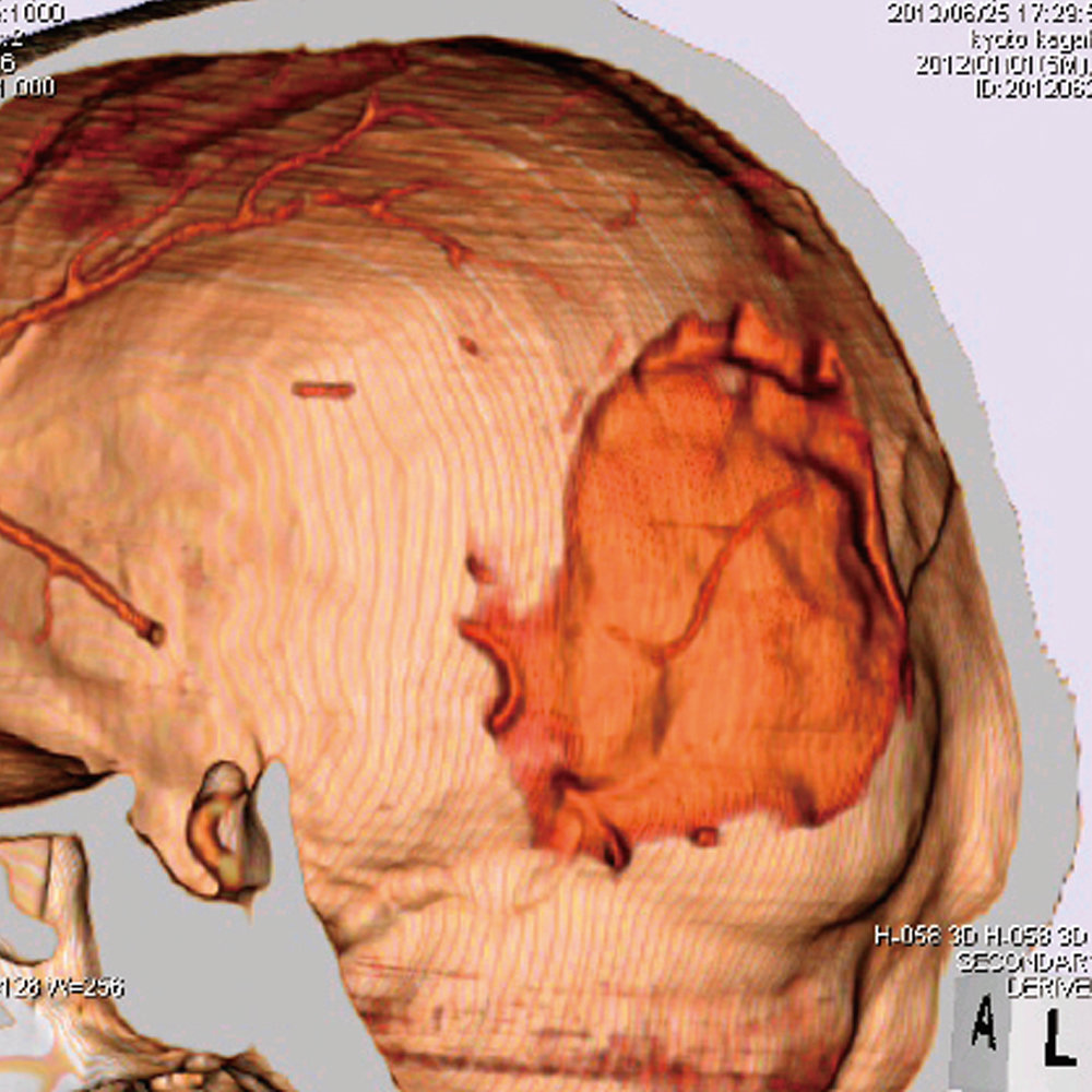 CT Whole Body Phantom - With Pathologies