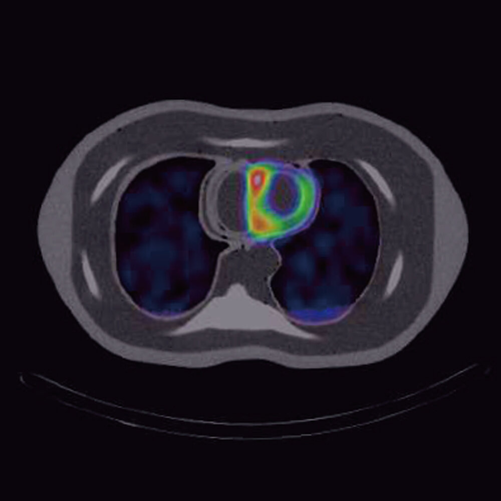 Thorax Phantom PET/SPECT