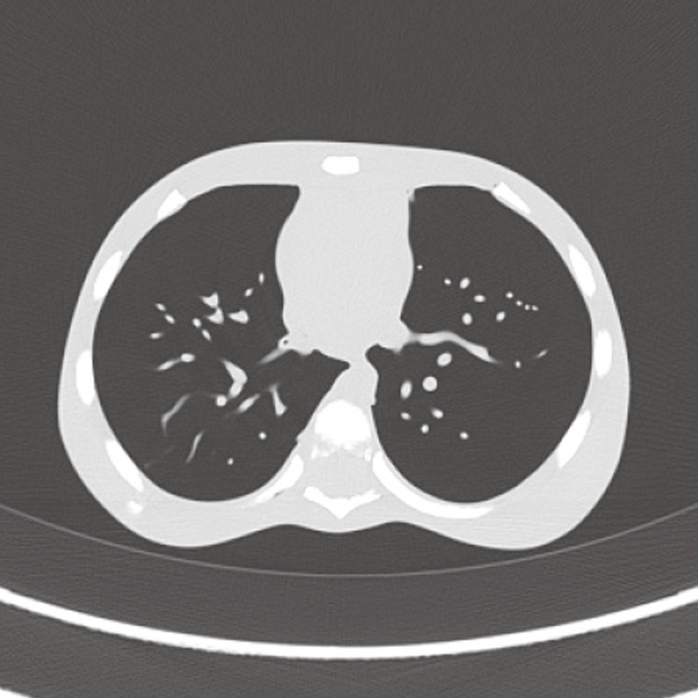 Paediatric Whole Body Phantom "PBU-70"